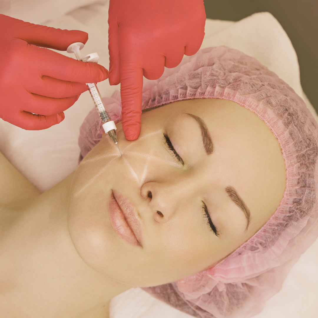 Biolifting (1 vial Hialurónico + Radiesse) – Híbrido Recolagenizador