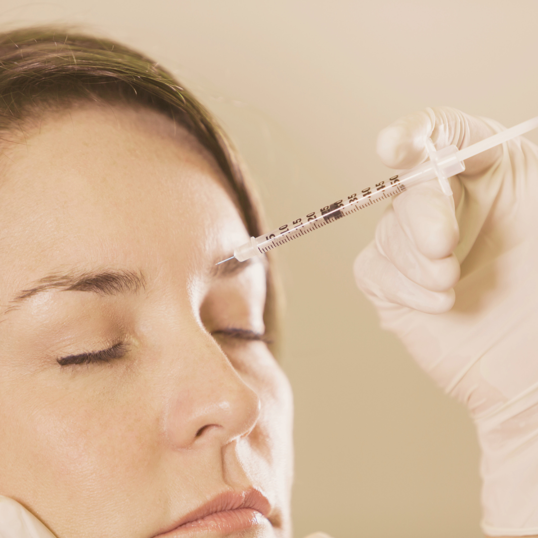 Toxina Botulínica + Peeling Químico